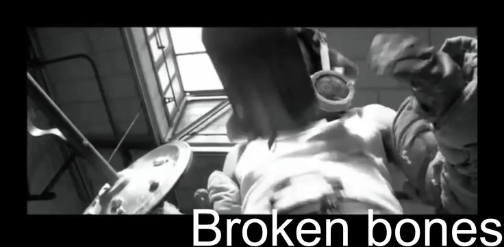 Broken Bones (5).jpg